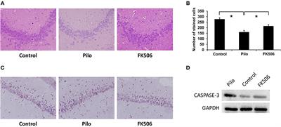 FK506 Attenuated Pilocarpine-Induced Epilepsy by Reducing Inflammation in Rats